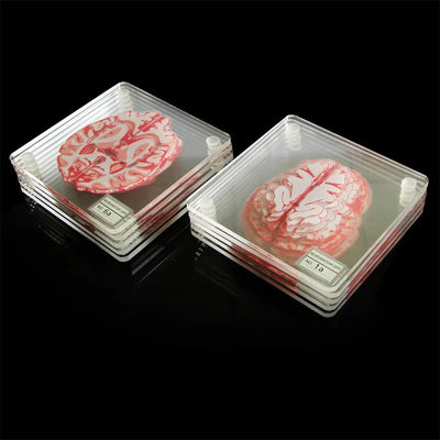Novelty Ten Piece 'Brain' Coaster Set in Unique Design